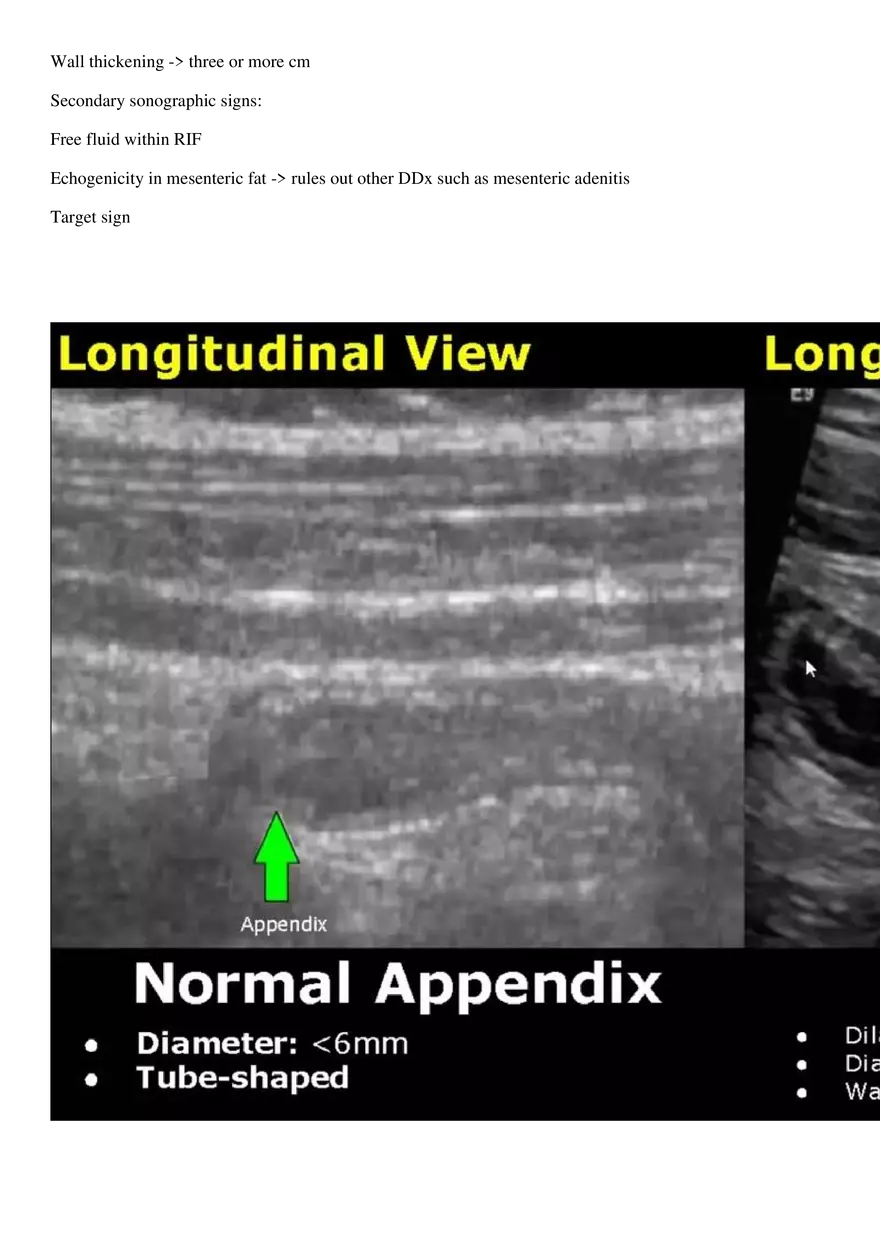 Appendicitis - Page 3