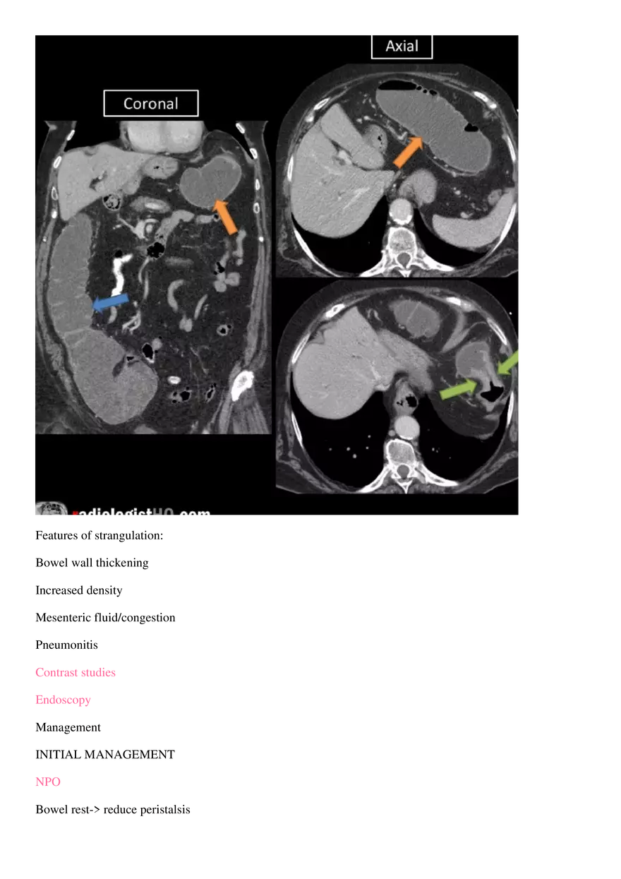 Bowel Obstruction - Page 8