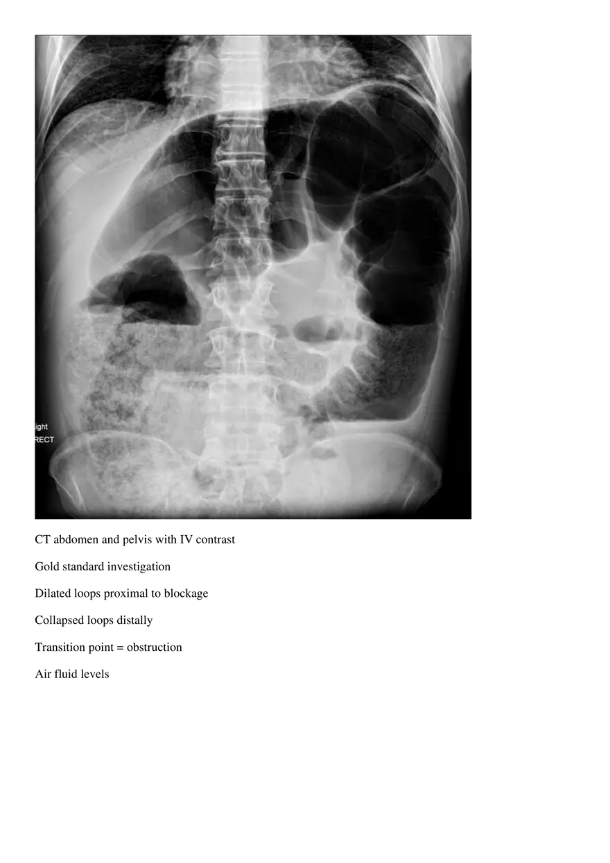 Bowel Obstruction - Page 5