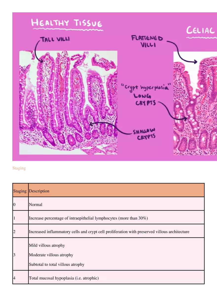Coeliac Disease - Page 4