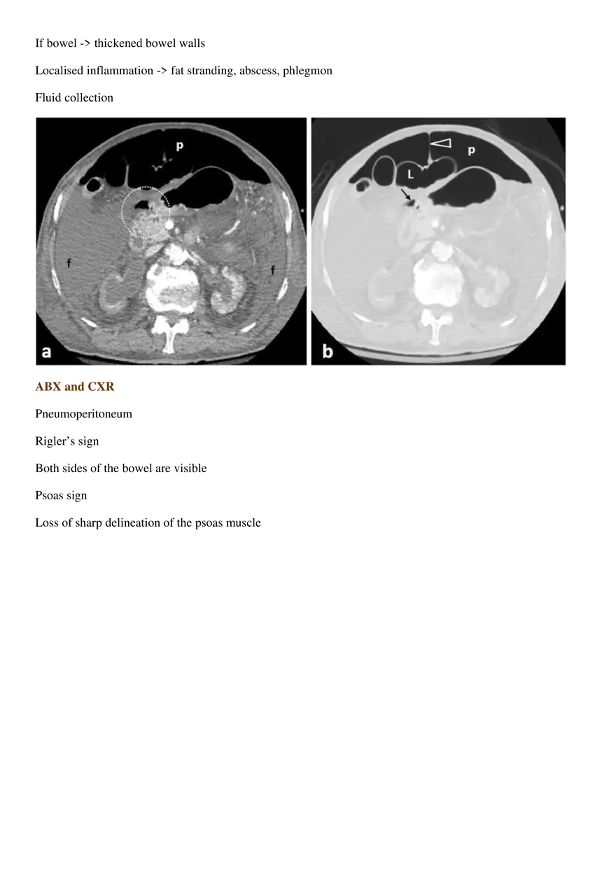 GI Perforation - Page 3