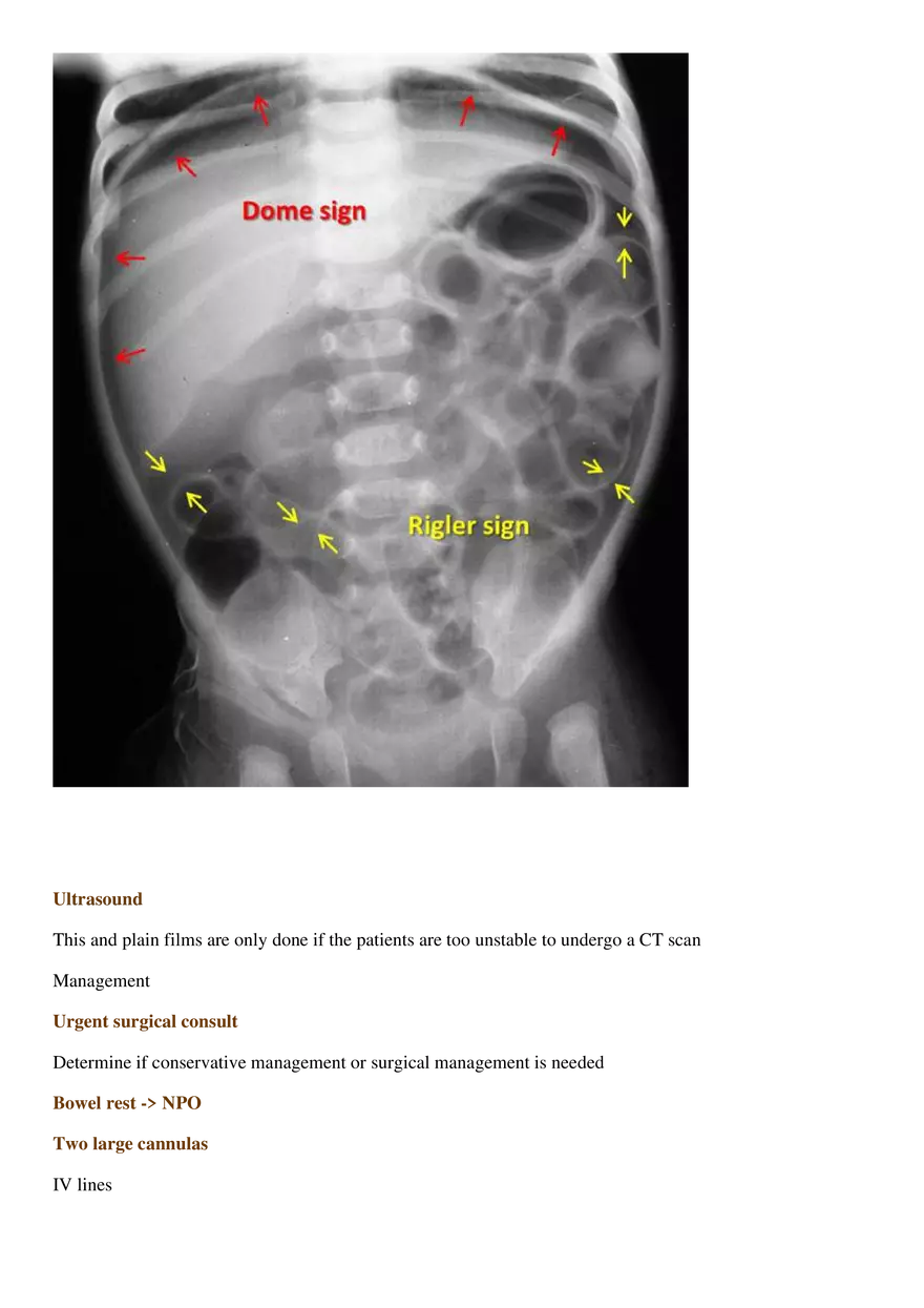 GI Perforation - Page 5