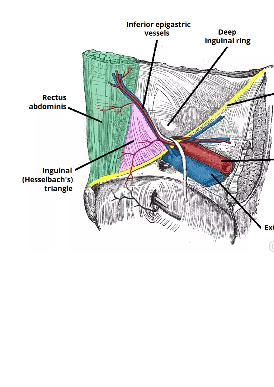 Hernia - Page 2