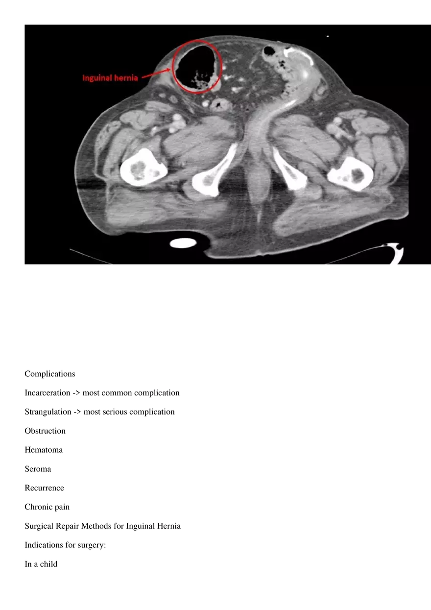 Hernia - Page 4
