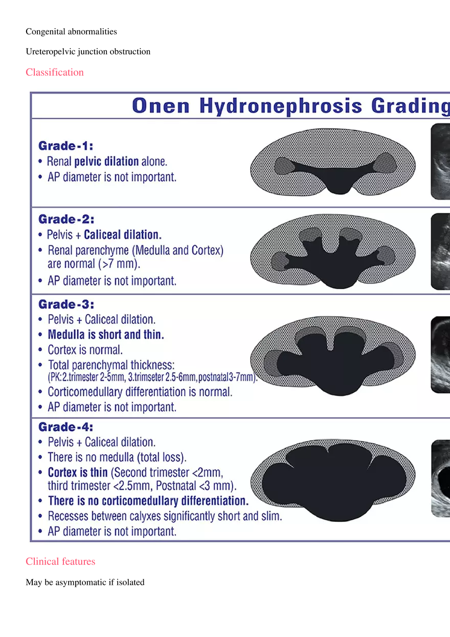 Hydronephrosis - Page 2