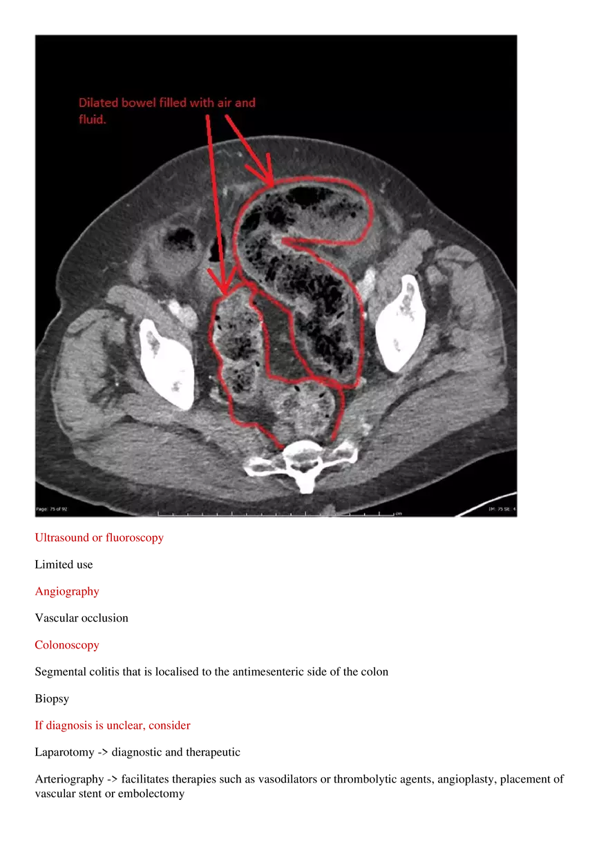 Ischemic Colitis - Page 4