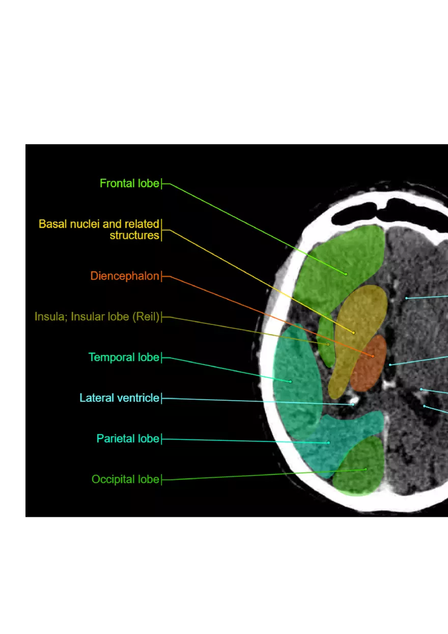 Ischemic Stroke and Transient Ischaemic Attack - Page 9
