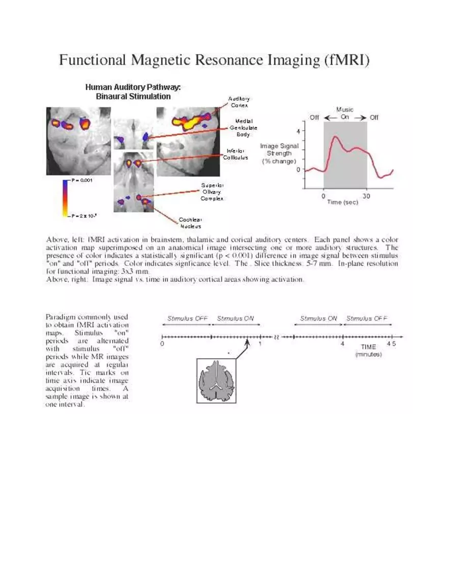 Neuroimaging Correlates of Human Auditory Behavior - Page 16