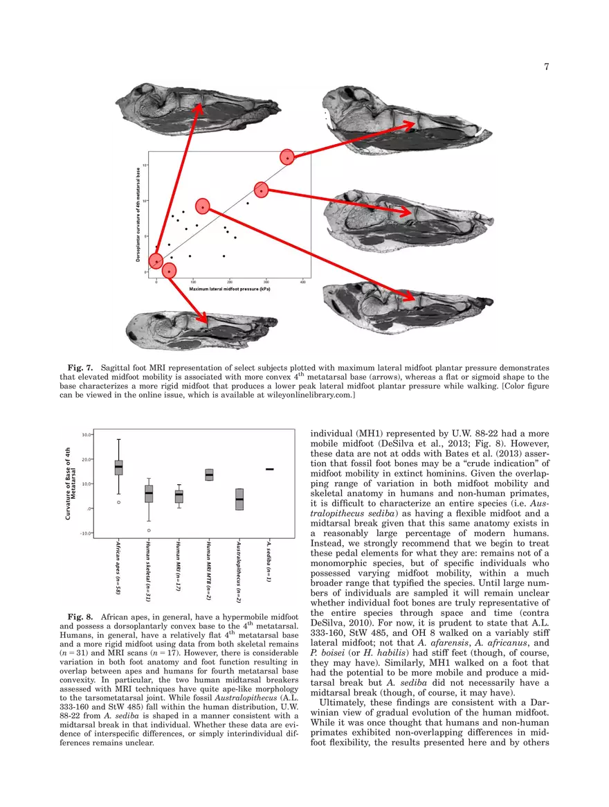 Midtarsal Break Variation in Modern Humans - Page 7