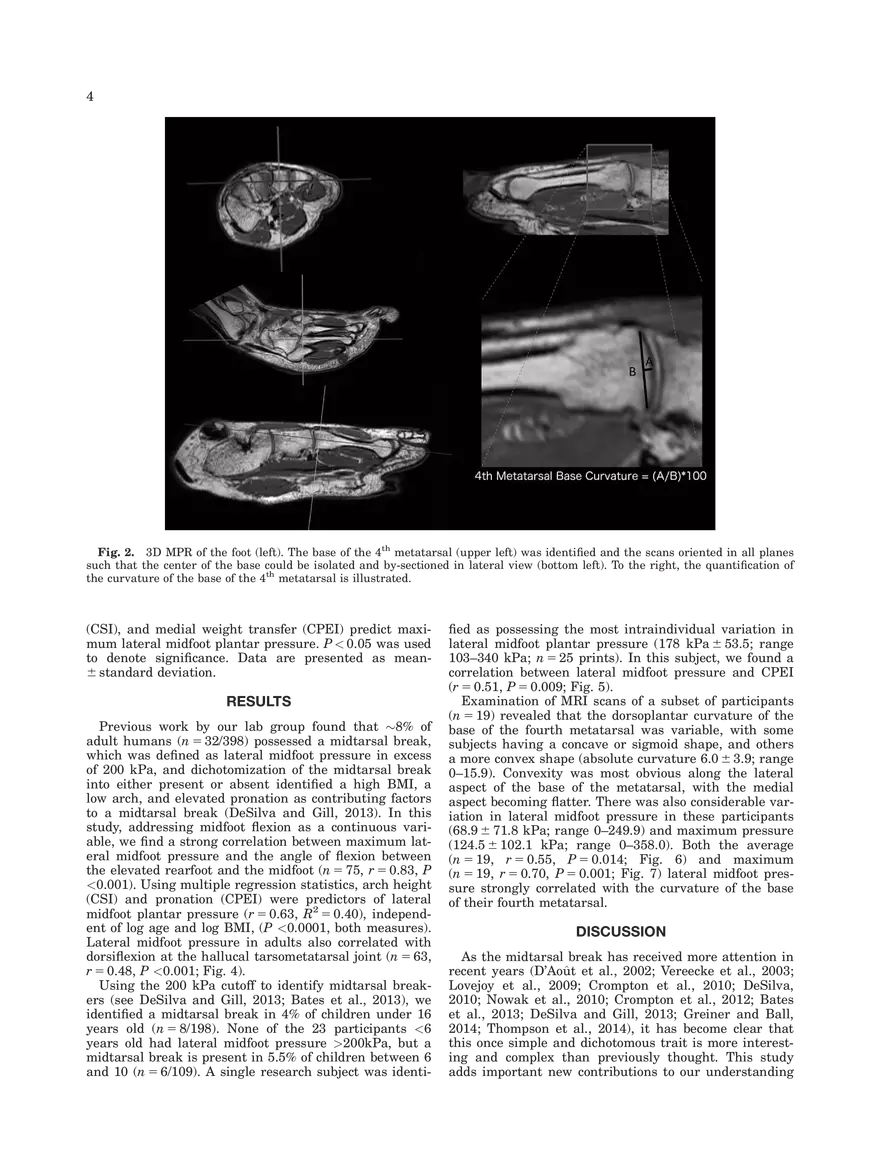 Midtarsal Break Variation in Modern Humans - Page 4