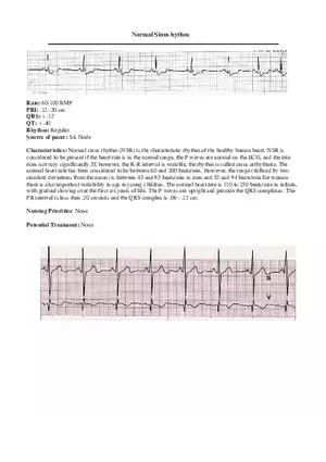 Atrial Flutter