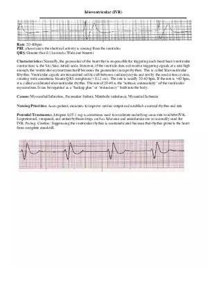 Idioventricular (IVR)