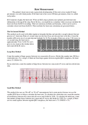 Atrioventricular Blocks