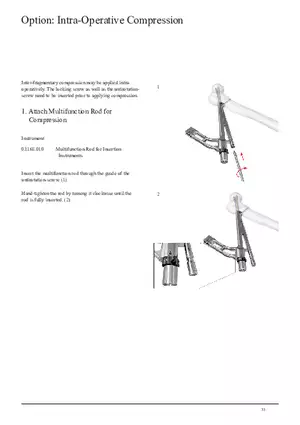 Femoral Neck Checking Option Intra-Operative Compression