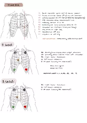 ECG Lead Placement