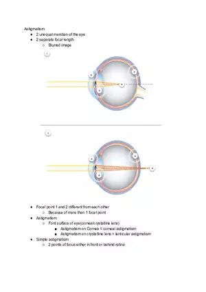 Astigmatism Study Notes