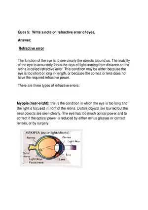 Ques 5 Write a Note Onrefractive Error of Eyes