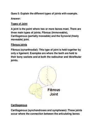Explain the Different Types of Joints with Example
