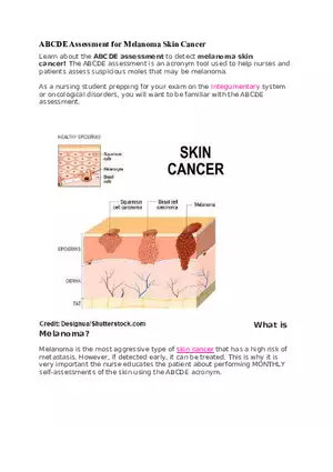Assessment for Melanoma Skin Cancer