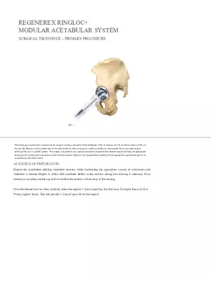 Regenerex Ringloc Surgical Technique