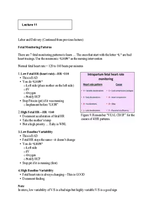 Nursing Exam Review Lecture 11 Fetal Monitoring Patterns