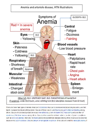 Anemia Atherosclerosis HTN Illustrations