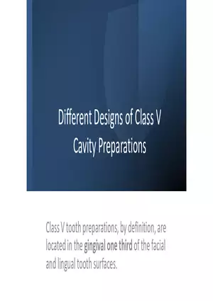 Different Designs of Class V Cavity Preparations