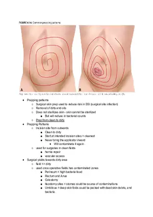 Common Prepping Patterns