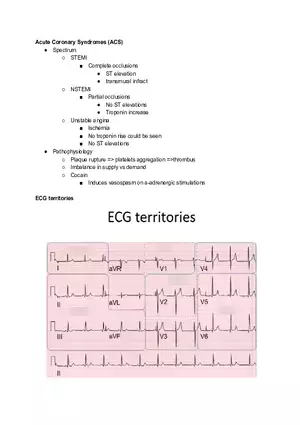Acute Coronary Syndromes (ACS)