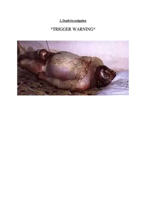 2. Death Investigation