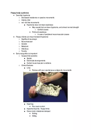 Floppy Body Syndrome