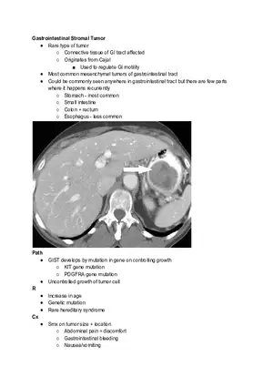 Gastrointestinal Stromal Tumor