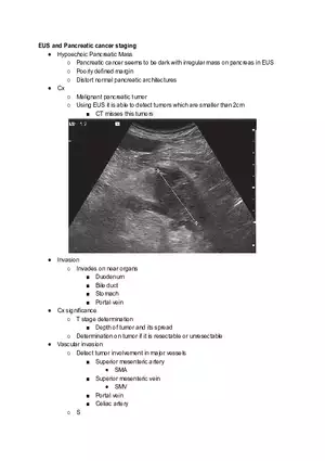 Pancreatic Cancer Staging