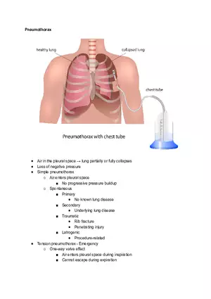 Pneumothorax