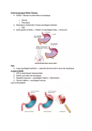 Gastroesophageal Reflux Disease