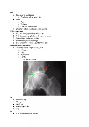 Osteoarthritis Pathophysiology