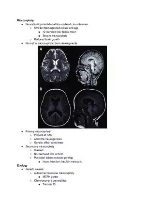 Microcephaly