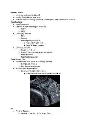 Placenta Praeiva
