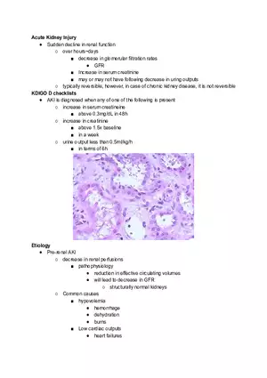 AKI - Acute Kidney Injury