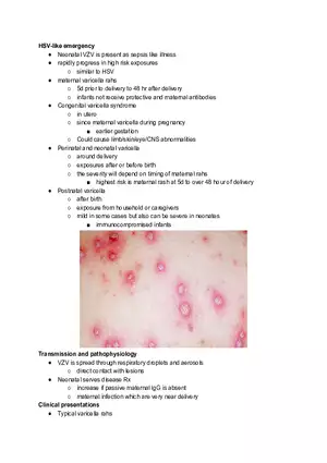 VZV Infection