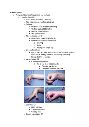 Cerebral Palsy